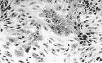 Οι ιοί προκαλούν χαρακτηριστικές κυτταροπαθολογικές αλλοιώσεις πρωτογενείς κυτταρικές σειρές