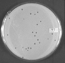 Καλλιέργεια των ιών Ανάπτυξη βακτηριοφάγων στο εργαστήριο:ησυγκέντρωσητουιού είναι ανάλογη από τον αριθμό των διαυγάσεων (plaques) που σχηματίζονται στο