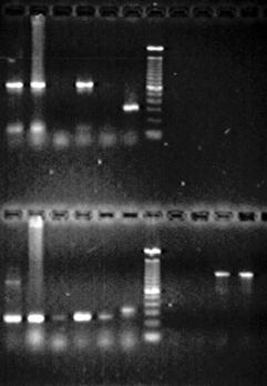 φορτίου) Sequencing (για έλεγχο αντοχής στα αντιϊκά φάρμακα) In situ υβριδισμός Microarrays: στον ίδιο χρόνο ανίχνευση ιϊκών γονιδίων για τυποποίηση,