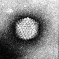 μήκοςτηςσπείραςτουdna ραβδοειδή μορφή, όλοι έχουν έλυτρο Συμμετρία των ιών 3)
