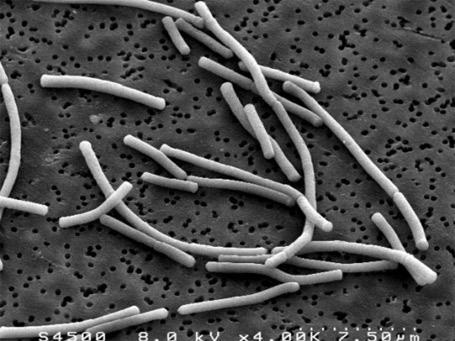 acidofilus : smotanová kultúra 1 : 9 Bifido nápoje 37 C Bifidobacter bifidum a/alebo