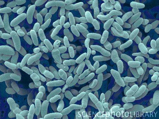 Oxidatívna fermentácia octové kvasenie Acetobacter aceti Acetobacter