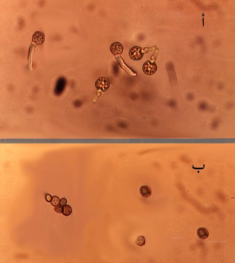 مجمة العم م ال ز راعية الع راقية 43)2( عدد) BN-33 العزلة مزرعة تأثير السائمة اباغ الفطر Rhizopus stolonifer تشير النتائج )شكؿ 5 ( إلى أف في أثر األباغ انبات عند الت اركيز %23 أباغ استعماؿ الفطر ال