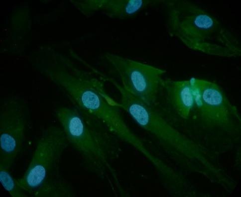 linia standard de glioblastom U87, nucleii coloraţi cu DAPI