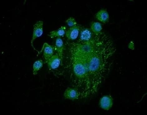 Nuclei coloraţi cu DAPI (albastru), Notch 2 cuplat cu