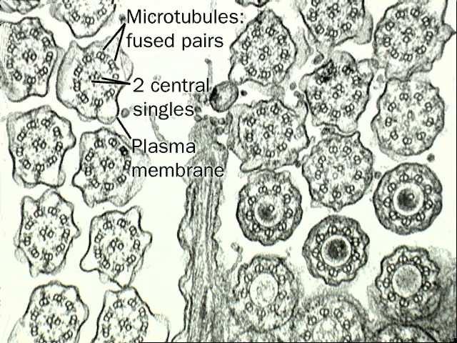 5 µm Poprečni presjek kroz aksonemu Mikrotubuli Plazma Bazalno tjelešce 0.1 µm 0.
