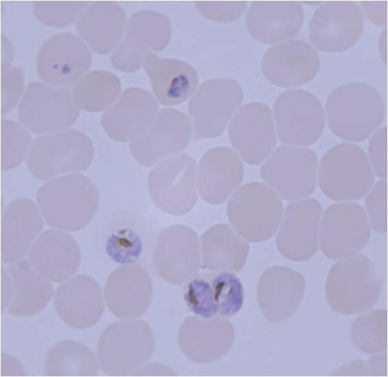 Toxoplasma gondii (παράσιτο της γάτας, υπεύθυνο για την εμφάνιση σοβαρών ασθενειών σε άτομα που πάσχουν από HIV και εγκυμονούσες γυναίκες)