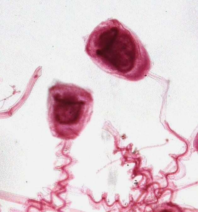 Μακροπυρήνας (πεταλοειδής) Vorticella nebulifera: