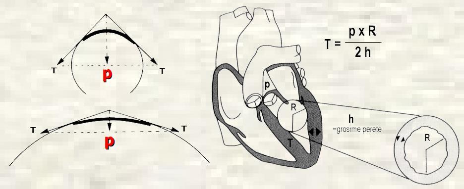 Tensiunea Parietala, Stresul Parietal Tensiunea parietala (T) forta care actioneaza asupra unei felii ipotetice de ventricul, tinzand sa traga marginile acesteia una spre cealalta.