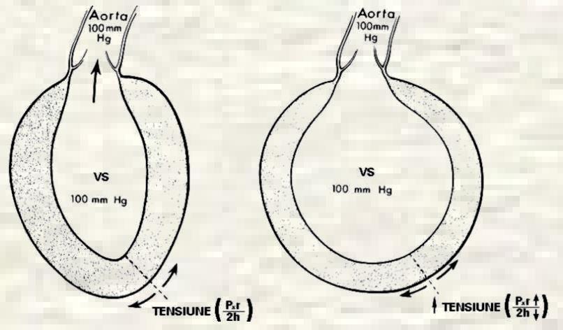 Legea lui Laplace este utila pentru a intelge conditiile de care depinde necesarul miocardic de oxigen; acesta este - Crescut de: - Cresterea presiunii ventriculare (hipertensiune, stenoza aortica) -