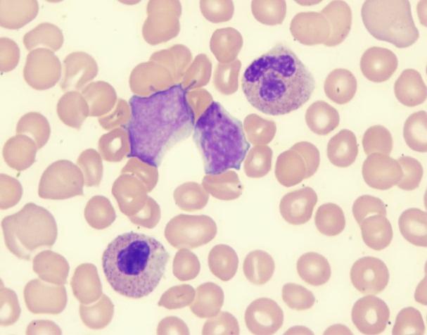 consider all their findings as related to their underlying diseases and do not constitute a new disease Some patients are not happy to move for examination from their