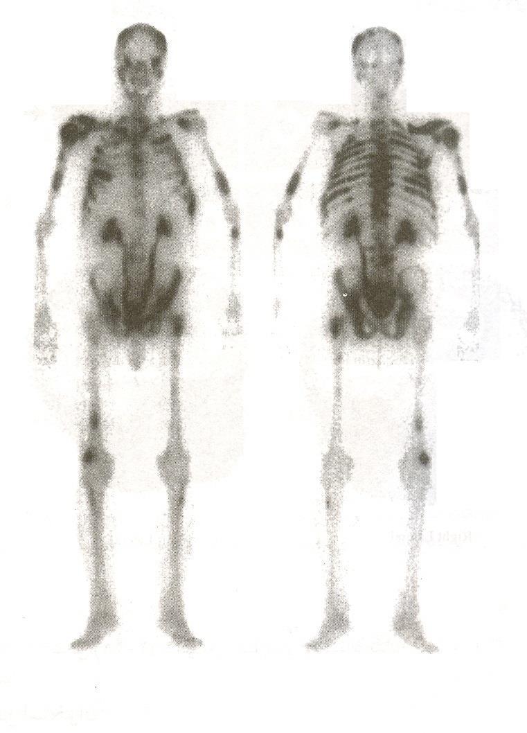 129
