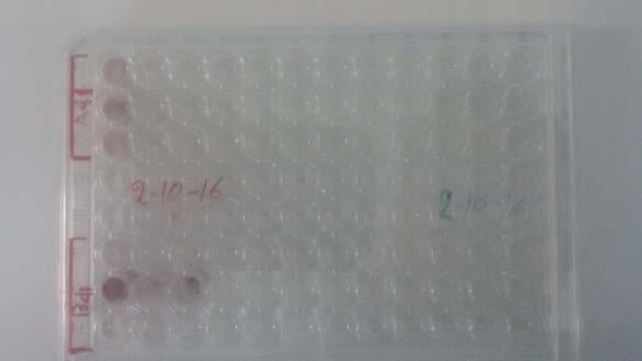 Εικόνα 15: ΜΡΝ microtiter plate για τα δείγματα Α41 και Β41 5.2.