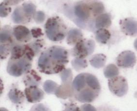 %Foam cells in microscope field TLRs קצף בהשוואה ליצירה הספונטנית של תאי הקצף, בתהליך.