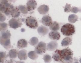 * 35 3 2 15 1 * * * * * 5 cells cells +LDL Pg MOI 2 Pg MOI 5 Pg MOI 1 Fn MOI 1 Fn MOI 5