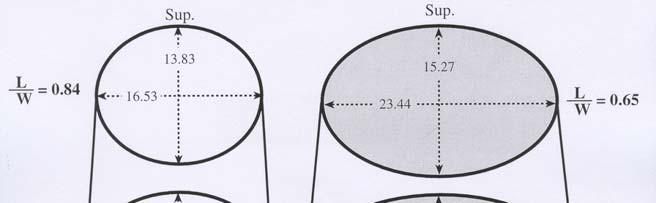 Relationship between length and width dimensions of inferior vertebral body: ethnic groups, age and sex combined (n= 277) 85% 80% Length / Width 75% 70% 65% 60% 55% 50% 45% 40% C3