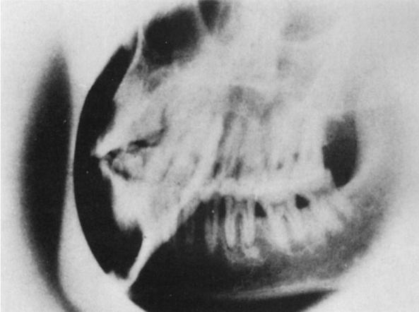 Jansen L: Dental radiography: principles and