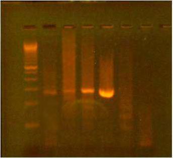 HPV-16 θετικά δείγματα, βρίσκεται στο ύψος των 291bp σύμφωνα με τον μάρτυρα μοριακού βάρους της Invitrogen.