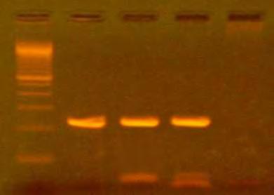 Στην παραπάνω εικόνα του πηκτώματος αγαρόζης παρατηρούμε τα προϊόντα 4 ενδεικτικών κλινικών δειγμάτων, τα οποία όπως ήδη αναφέρθηκε χρησιμοποιήθηκαν για την ενίσχυση με PCR τμήματος της L1 περιοχής