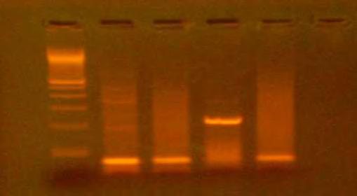 μελέτης αυτής ενισχύουν τμήμα του γονιδίου L1 μόνο του στελέχους HPV-33, είναι δηλαδή τυποειδικοί, και η αντίδραση της PCR πραγματοποιήθηκε επιτυχώς χωρίς την παρουσία επιμολύνσεων. 6.2.