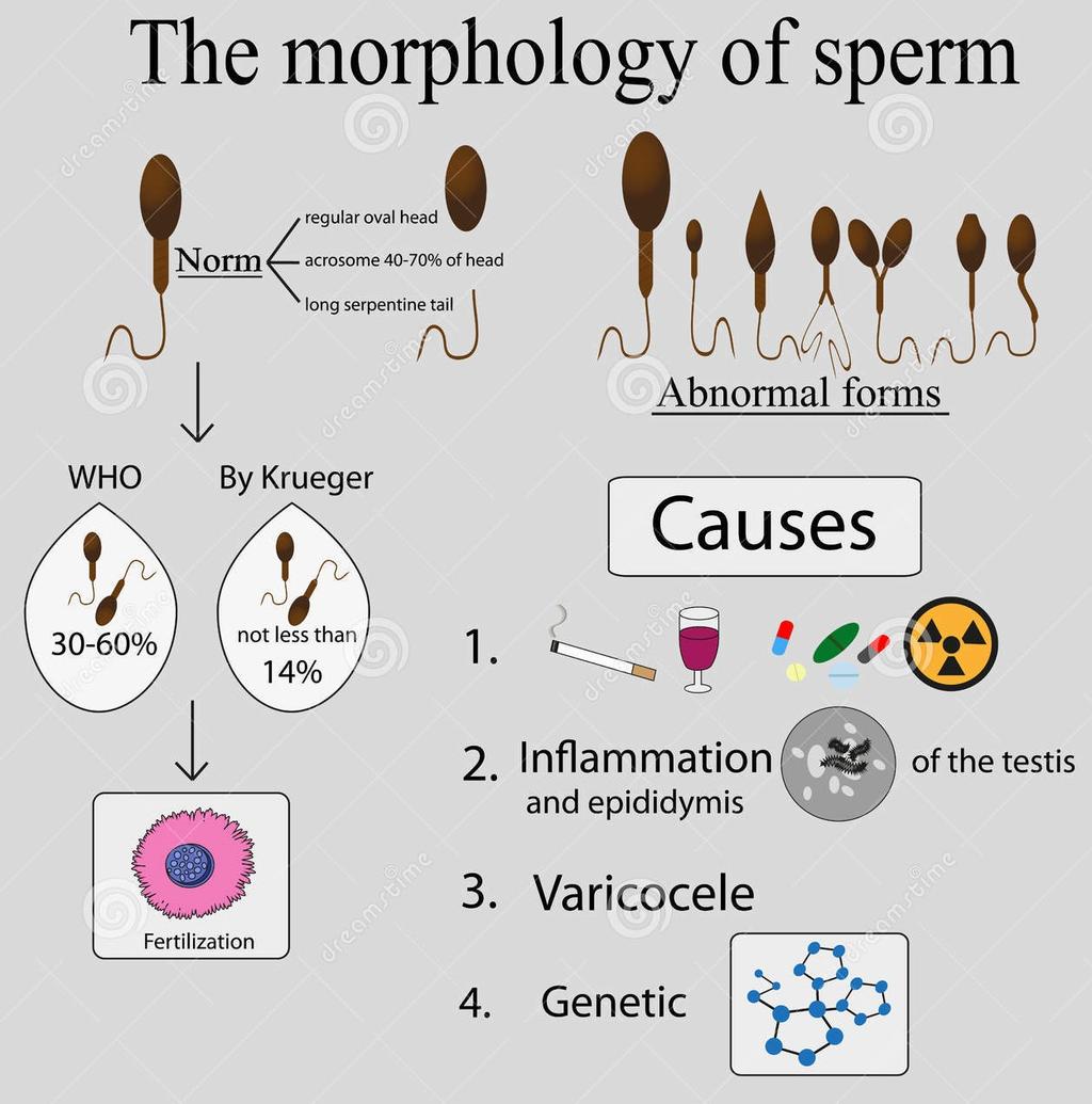 Sperm morphology patterns: Μοτίβα Μορφολογίας Κλινική προσέγγιση Αναφορά της επικρατούσας ανωμαλίας κεφαλής, ώστε να