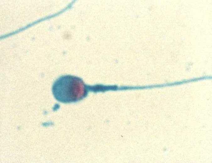 Sperm morphology patterns: Μοτίβα Μορφολογίας Large acrosomes Spermac