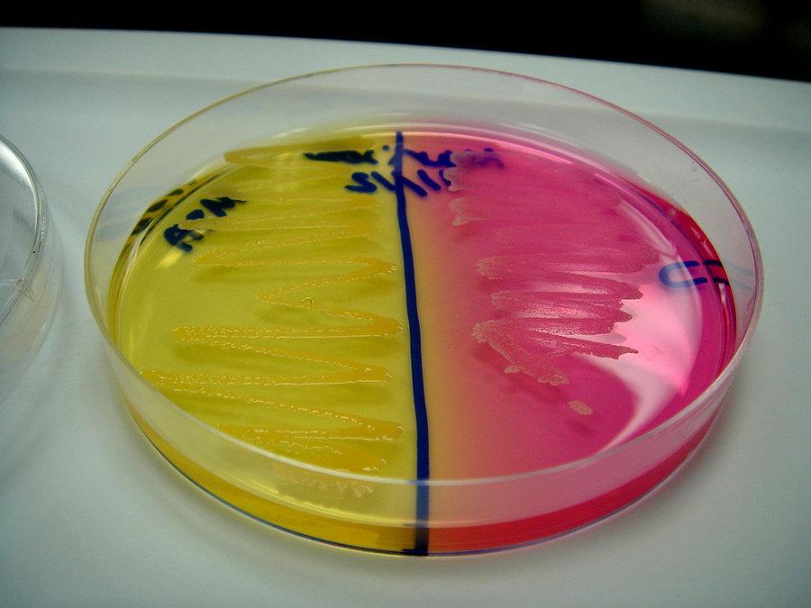 biochimica a tulpinii) Componente: geloză simplă +