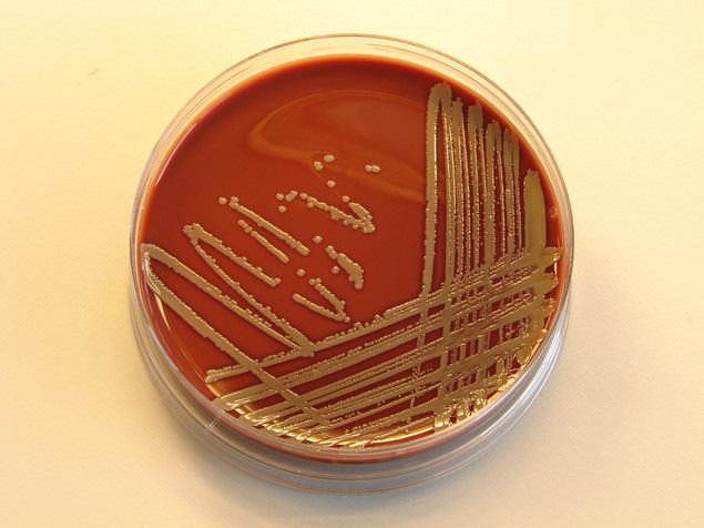 Clasificarea mediilor de cultura Medii complexe de utilitate generala: - uzuale - cu proteine native Medii speciale selective de imbogatire anaerobi teste biochimice Caracterele culturii microbiene