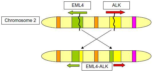 αποτέλεσμα μία πρωτεΐνη σύντηξης EML4ALK, η οποία περιέχει την περιοχή πρωτεϊνικής κινάσης της ALK συντηγμένη στο N-τελικό άκρο του EML4.