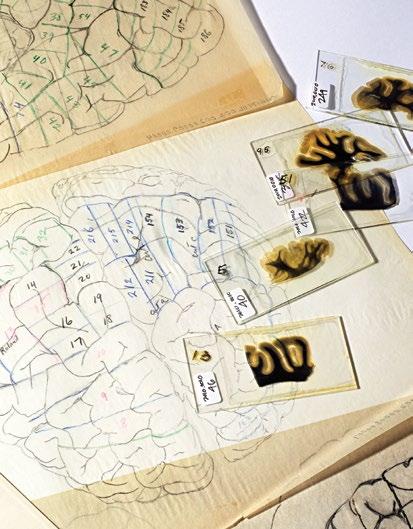دويليمان عبقري في زجاجة إن عقودا من فحص دماغ آينشتاين
