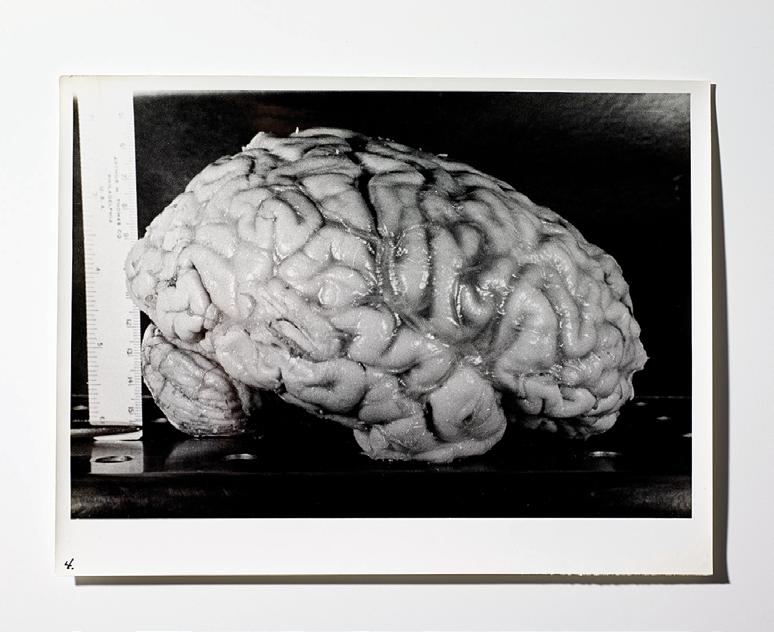 علم األعصاب غوتنغن University of Göttingen عىل ترشيح جثته واستخرجوا دماغه.