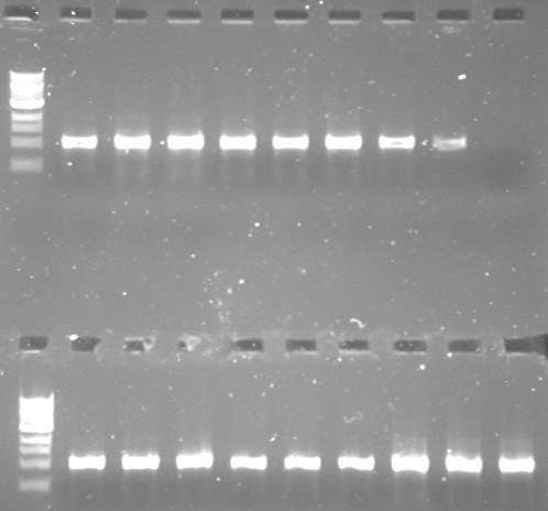 L 1 2 3 4 5 6 7 8 1000 bp 500 bp L 9 10 11 12 13 14 15 16 17 Εικόνα 3.
