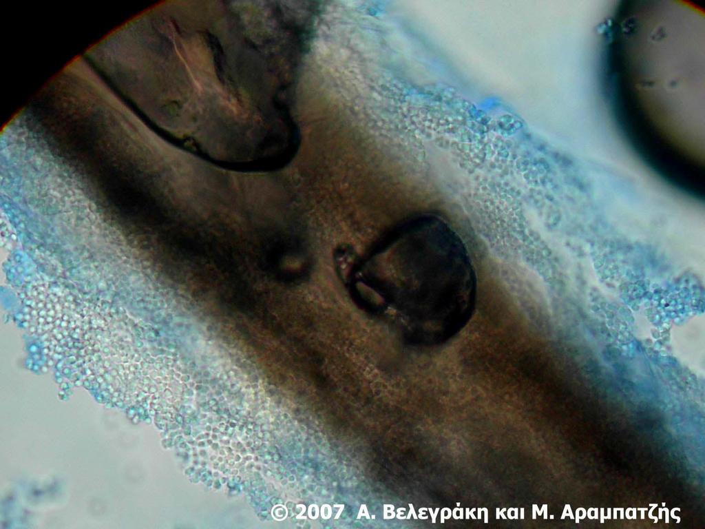 Λοίμωξη τρίχας από Microsporum canis, εξωτριχικού τύπου (δηλαδή τα σπόρια του μύκητα βγαίνουν έξω από το σκληρό εξωτερικό