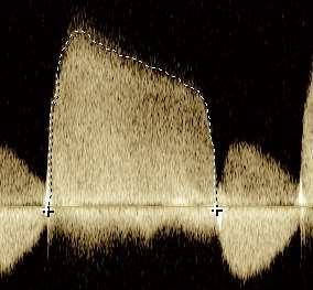 EROA = 2πr² x Va /VmaxAR r