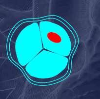 ascendentne aorte