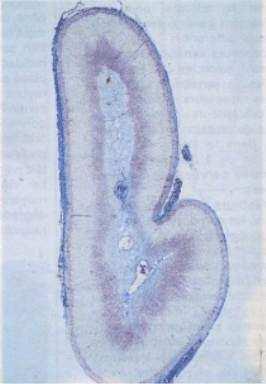 Stresul este receptat si integrat la nivelul nodulului paraventricular al hipotalamusului.