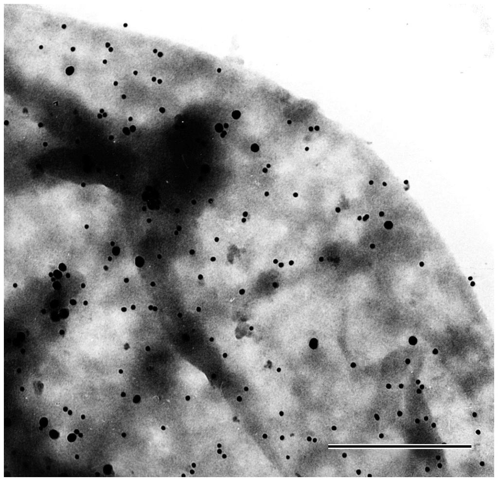 Imunoelektronska mikroskopija vizualizacija specifičnih intracelularnih komponenti oznaka visoke elektronske gustoće feritin (globularni protein plazme, veže željezo) čestice koloidnog zlata