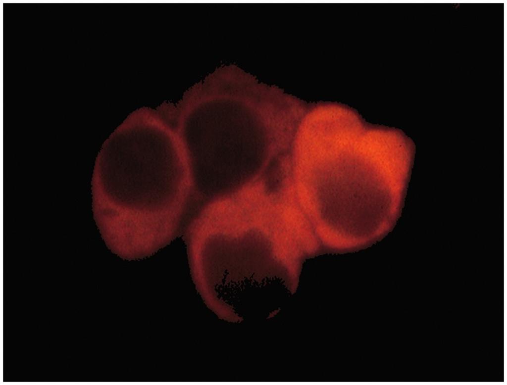 Detekcija IgM protutijela pomoću anti-igm protutijela s konjugiranim rodaminom Detekcija β stanica