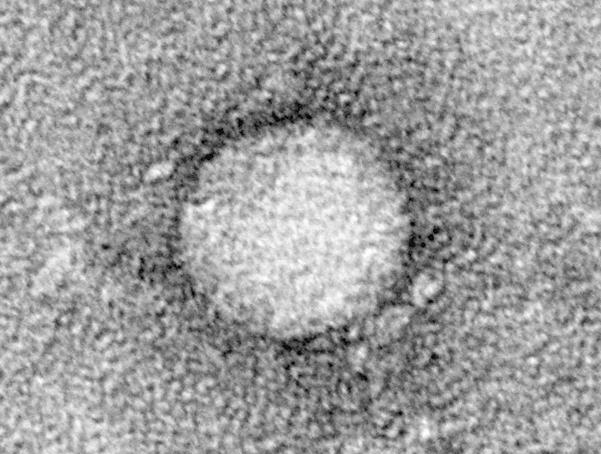 HCV Πρόκειται για RNA-ιό (hepacivirus) ο οποίος μπορεί να προκαλέσει