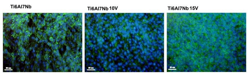 Figura 23. Expresia genica pentru osteocalcina si osteonectina in celulele liniei MG63 la 7 zile de la insamantarea pe probele de Ti cu depuneri de Glicerol:H 2 O(60:40 vol. %) + 0.5 wt.
