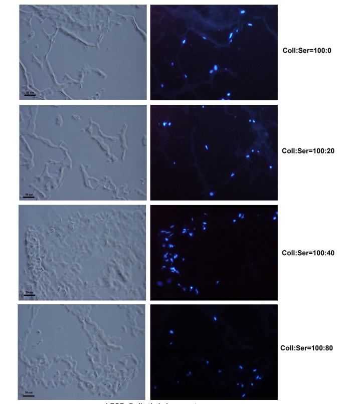 elongarea prelungita la 68 C, 7 minute. Produsii RT-PCR au fost analizati pe un gel de agaroza 1,5% colorat cu bromura de etidiu, iar cuantificarea s-a realizat cu programul TOTALLAB.