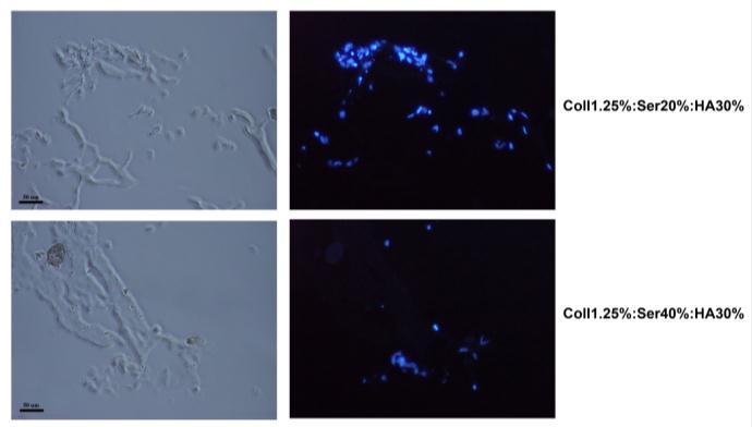 osteoprogenitoare hfob1.19.