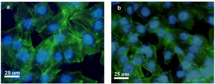 ca osteonectina si osteocalcina sunt proteine prezente in matricea extracelulara cu rol in procesul de mineralizare.