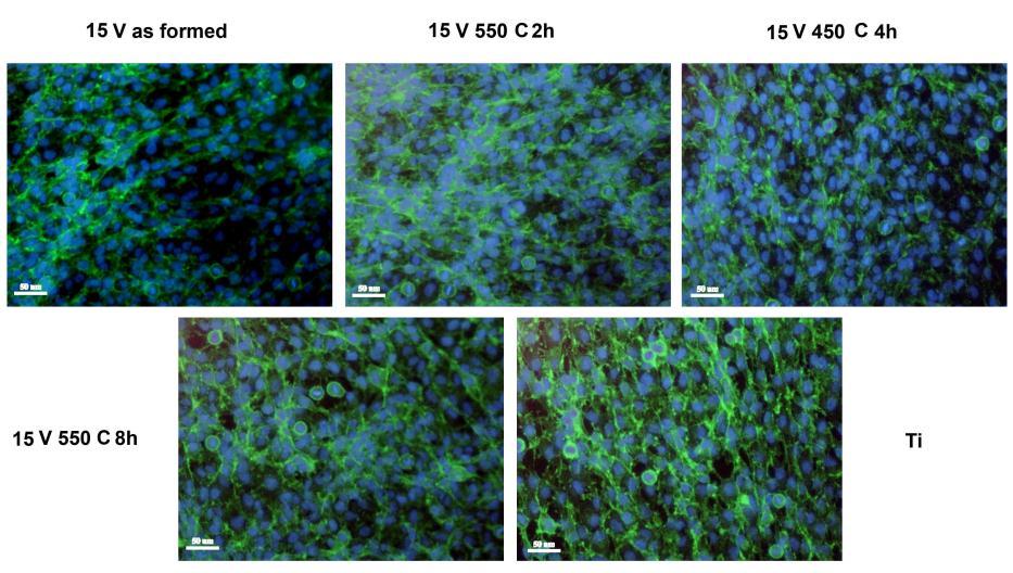 Figura 20. Morfologia celulelor osteoblast-like la 5 zile de la insamantarea pe probele de Ti cu acoperiri depuse la 15 V Figura 21.
