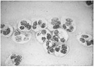 Amplification Tests) N.gonorrhoeae.