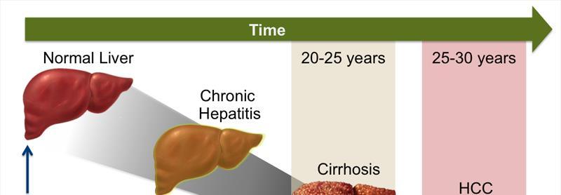 (2013). Hepatiti C Fact Sheet No 164.