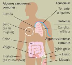 O cancro non é unha única