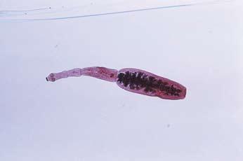 תמונה.2 Echinococcus - צסטודה תמונה.1 Scabiei Sarcoptes Dr. Peter M. Schantz, http://phil.cdc.gov הדבקה לילדים אפשרית, אך נחשבת לקלה ונדירה יחסית.