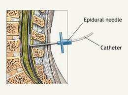 nociceptive venite pe caile A- δ si C.
