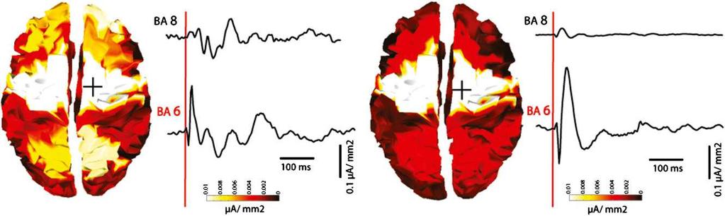 Corticalizarea durerii Starea de constienta este consecinta transformarii functionale a informatiei continuta intr-o retea neuronala (Buzsaki, 2007), cea mai imporatnta fiind reteaua frontoparietala